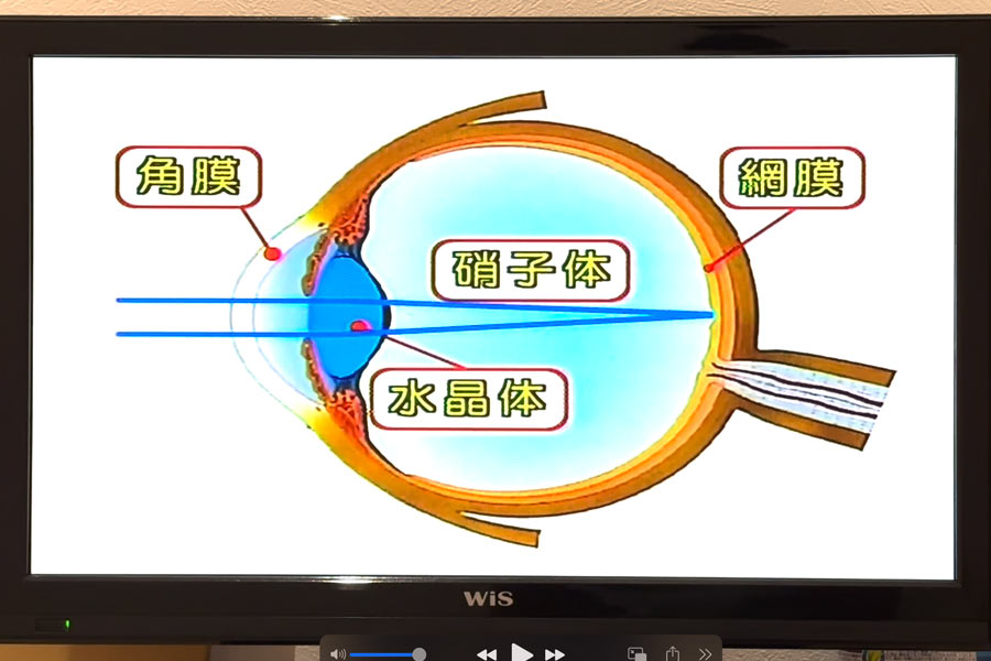 視力が1.2に